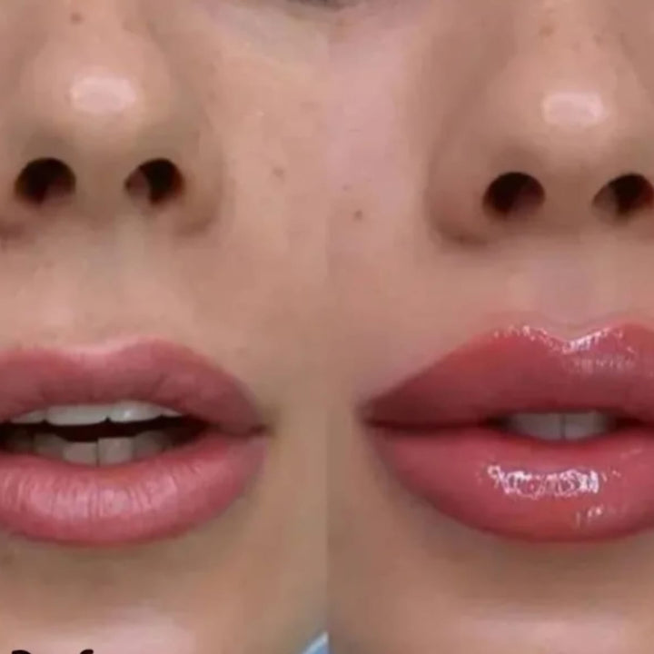 VOLUMINIZADOR DE LABIOS